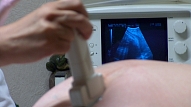 Eksperti: jaundzimušo mirstību perinatālajā periodā var samazināt sabiedrības izglītošana