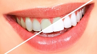 Speciālista ieteikumi zobu veselības saglabāšanai