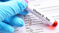 Jaunākajos pētījumos atklāj D vitamīna lomu cīņā pret Covid-19