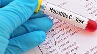 Austrumu slimnīcas infektologi un hepatologi aicina pieteikties C hepatīta un/vai HIV bezmaksas testiem – agrīna diagnostika ir izšķiroša