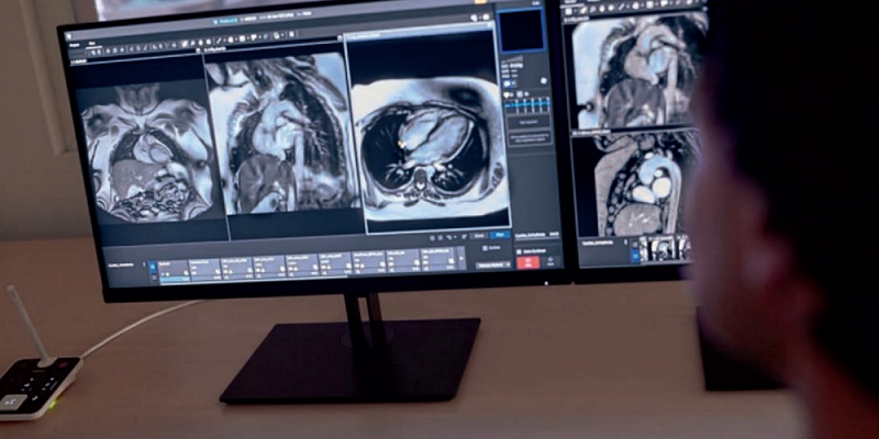 Kas jāzina par magnētiskās rezonanses izmeklējumu