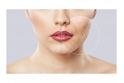 Veic dermatoskopiju
