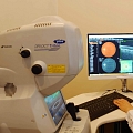 Optiskais koherentais tomogrāfs (OCT) tīklenes analīze