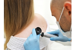 Muguras ādas izmeklēšana, izmantojot dermatoskopiju, lai savlaicīgi konstatētu iespējamās ādas slimības vai veidojumus.