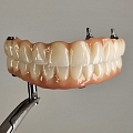 Zobārstniecības klīnika FamilyDent