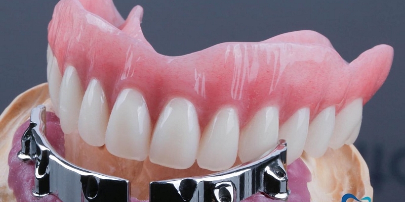 Zobu implantu cenas