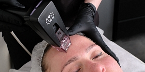 Aparātu kosmetoloģija