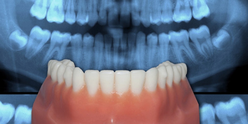 Ortodontija (sakodiena labošana)