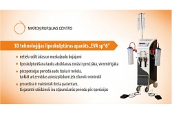 Liposkulptūras aparāts