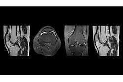 MRI Teika