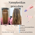 Matu rekonstrukcija – rezultāts pirms un pēc procedūras.
