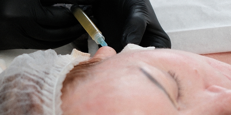 Injekciju kosmetoloģija